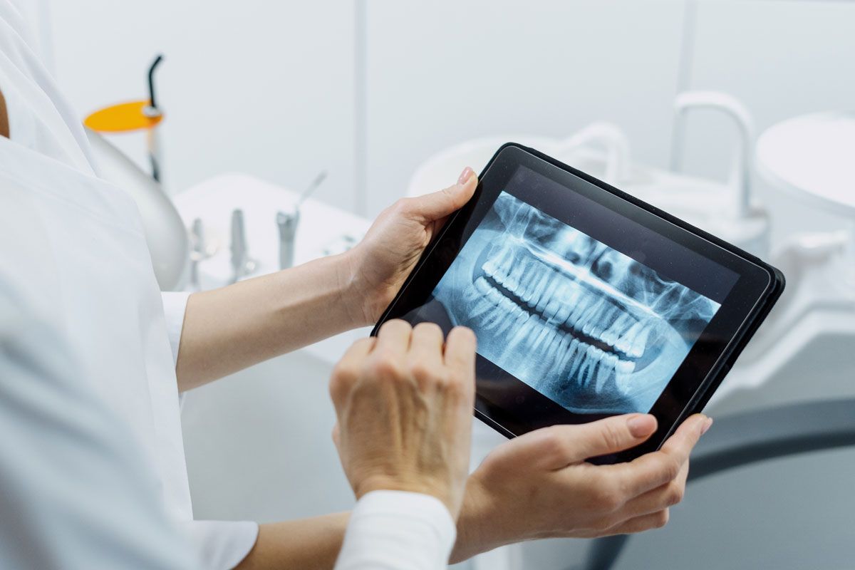 canary-dental-digital-x-rays-1358841457-updated